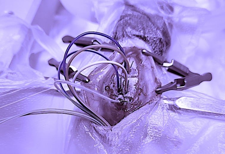 Aseptic epidural EEG electrode placement surgery in a rodent model using stereotaxic equipment